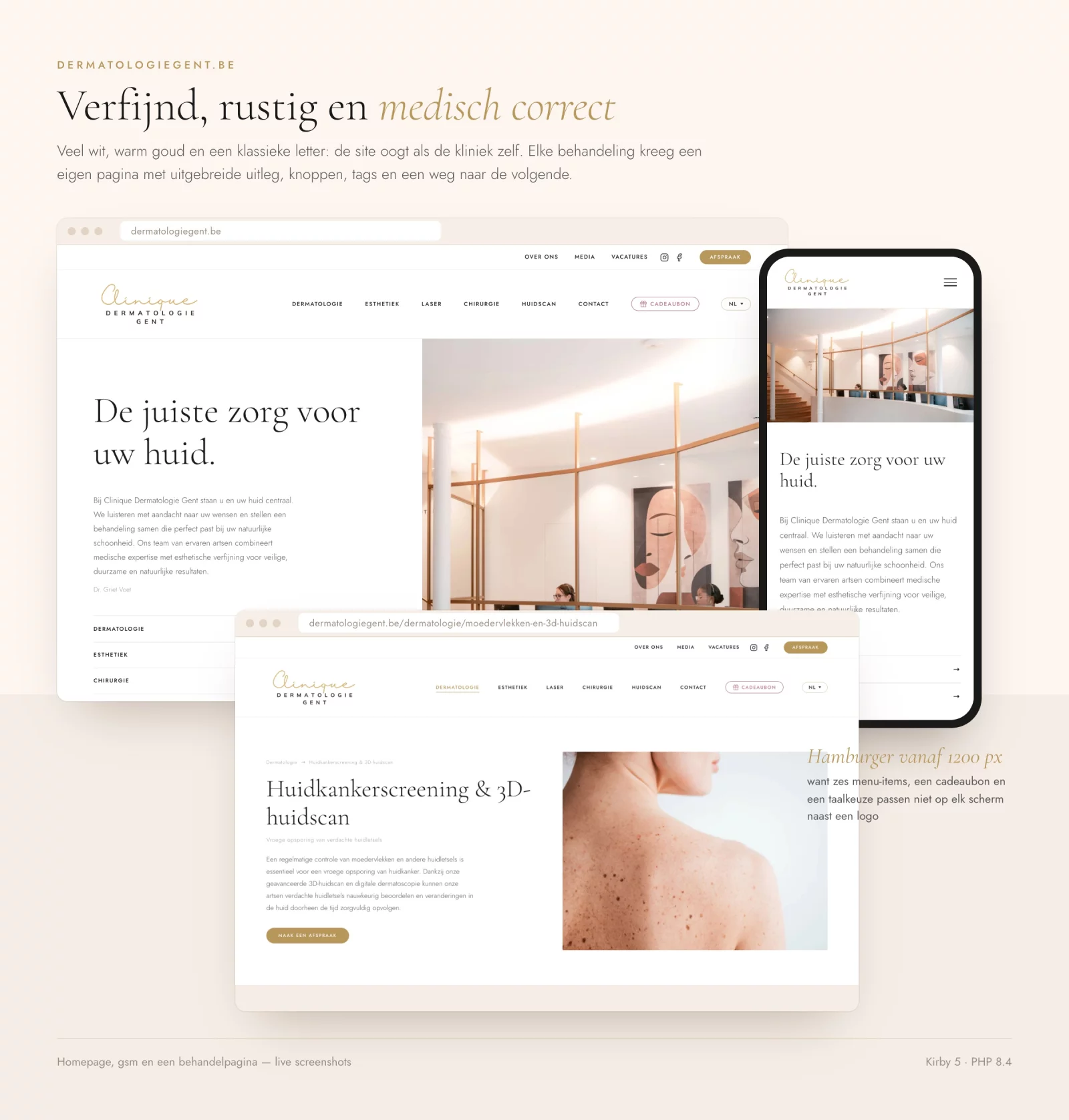 Homepage, mobiele weergave en een behandelpagina van dermatologiegent.be